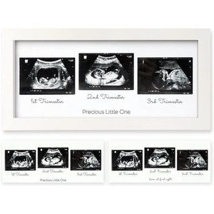 Sonogram Picture Frame - Trio Ultrasound Picture Frames  -  (Alpine White)
